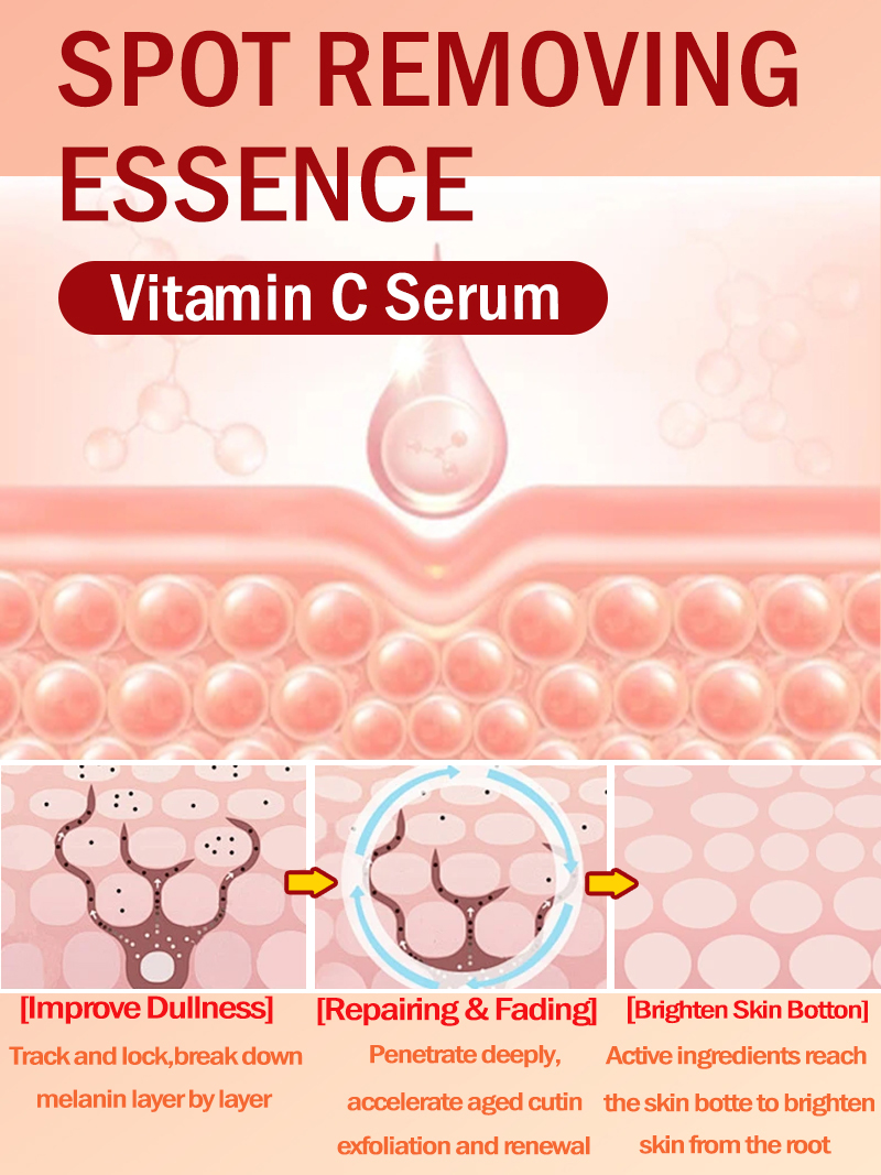 Çilleri, Melazmayı ve Yüzdeki  - Luxury Skincare Essence incelemesi ve fiyatı